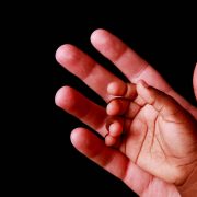 爱那些被放弃的孩子——访儿童救助机构创始人张雯