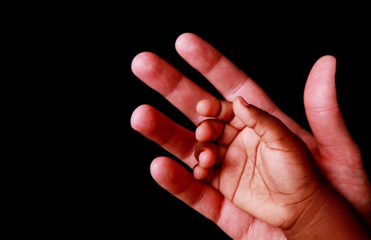 爱那些被放弃的孩子——访儿童救助机构创始人张雯